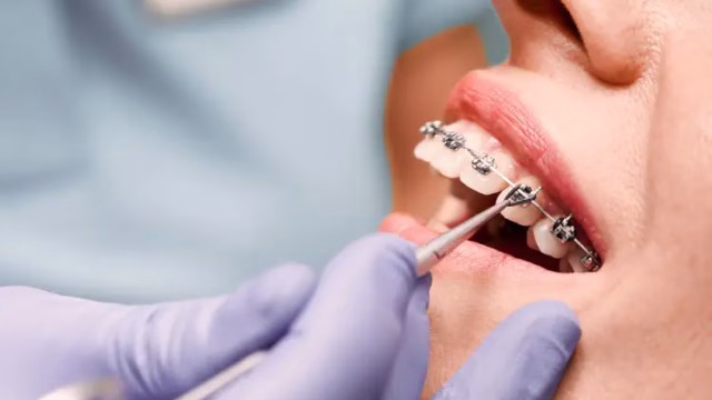 Orthodontics